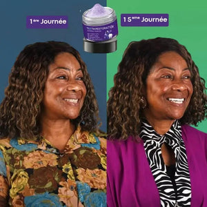 HZA Teeth – Traitement professionnel de blanchiment dentaire