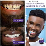 Charger l&#39;image dans la galerie, HZA Teeth – Traitement professionnel de blanchiment dentaire
