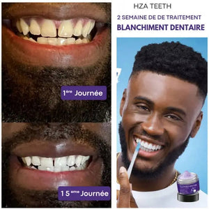 HZA Teeth – Traitement professionnel de blanchiment dentaire